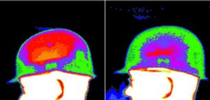 Slika Zračenje čelade